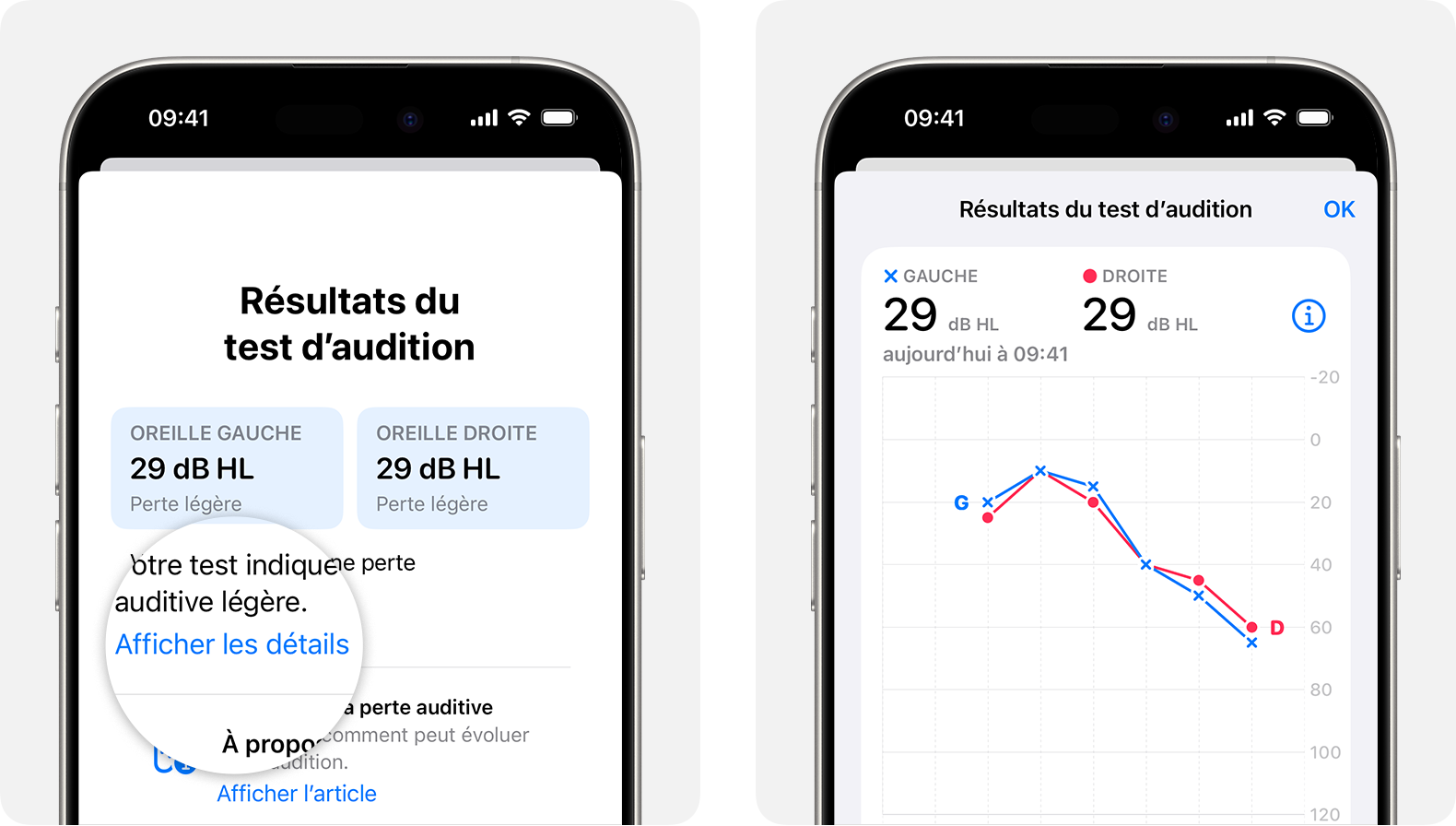 Résultats détaillés d’un test d’audition effectué avec les AirPods Pro 2 sur iPhone.