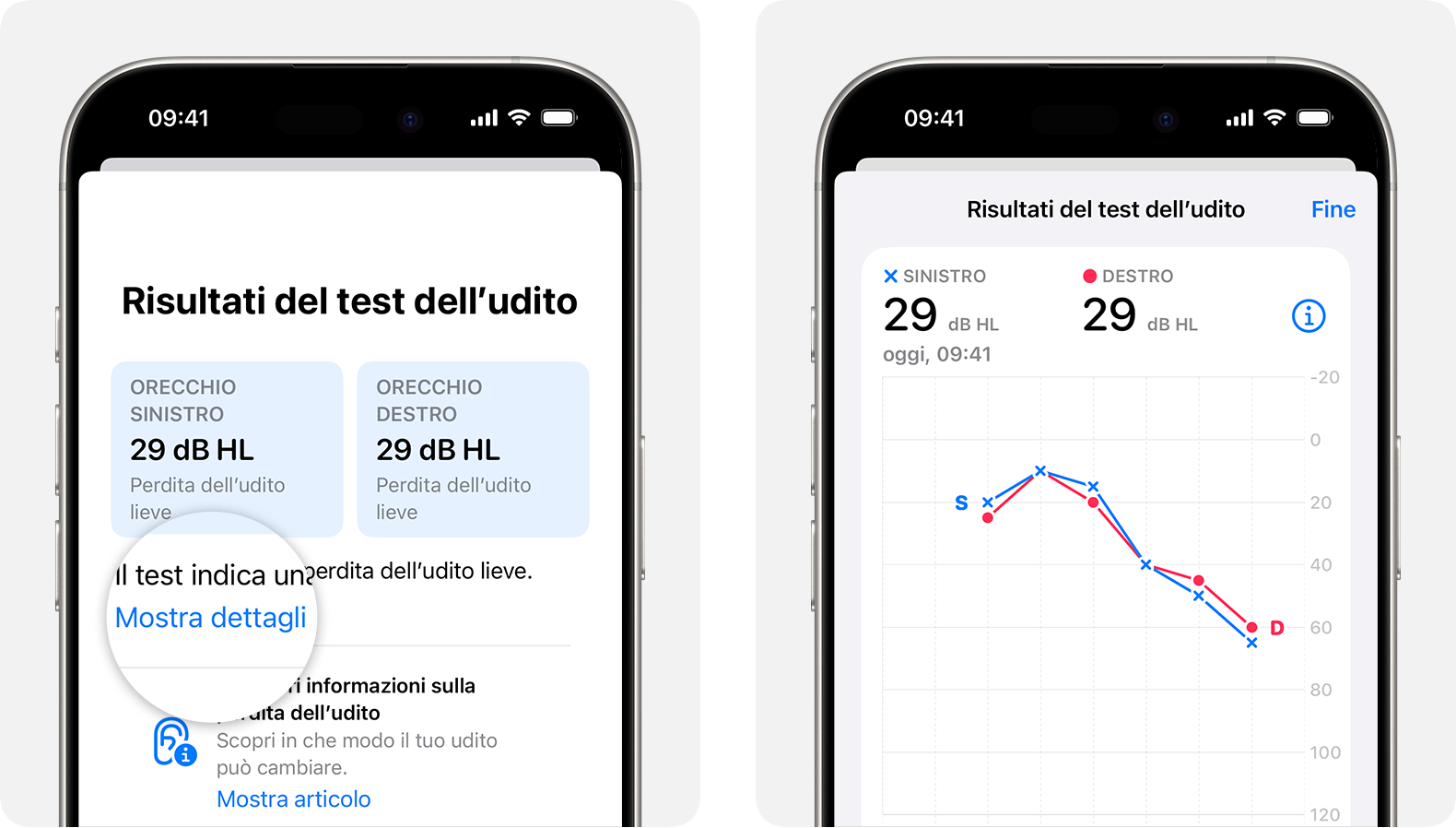 Risultati dettagliati di un test dell'udito eseguito con AirPods Pro 2 su iPhone.